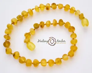Healing Amber Baltic Amber Anklet/Bracelet - Raw Gold